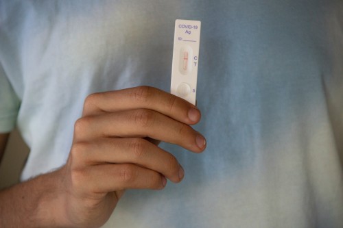 Коронавирус в Испании: установлена максимальную стоимость антиген-тестов на уровне 2,94 евро