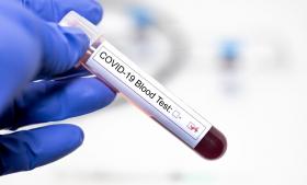 В целях профилактики заражения коронавирусом в Испании у медработников будет проведено тестирование препаратов